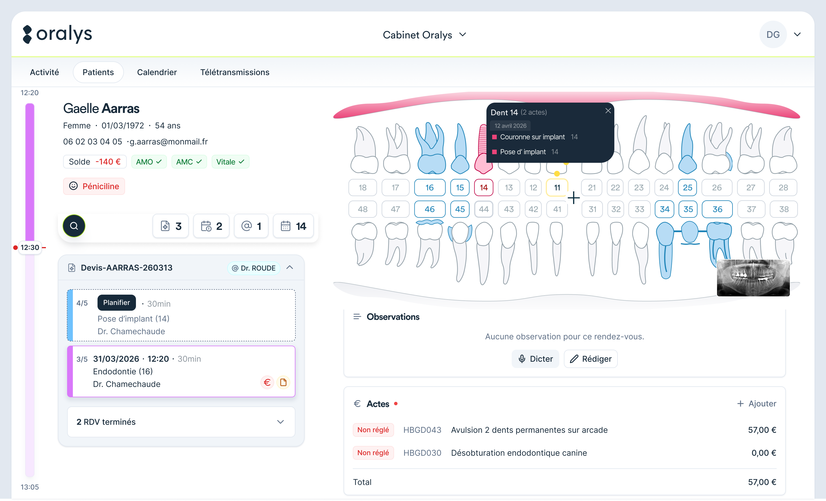 Aperçu de l'interface Oralys — Fiche patient